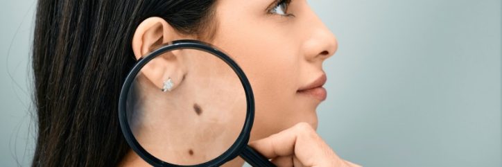 Understanding Skin Biopsy: Purpose, Types and Recovery