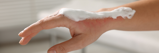 The Effect of Burns on our Skin and Why They are Dangerous.