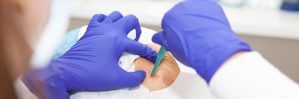 Instruments & Diagnostics > Biopsy Punches