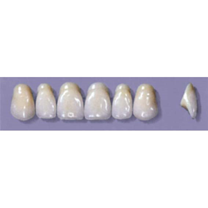 Myerson Anteriors #A72/58 (1 x 6 Card), Each