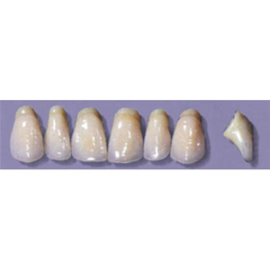 MYERSON ANTERIORS #PW8/60 (1x6CARD) Card