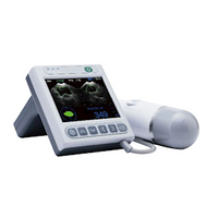 SignosRT Bladder Scanner, Each Each