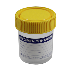Sarsted Specimen Sample Container, 70mL, with Yellow Screw Cap and Temperature Indicator Strip with Cdeg and Fdeg Scales, Labelled, Polypropylene, 500 Pieces/Carton Carton