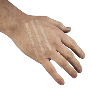Surgi Reinforced Wound Skin Closure Strips C-01, 3 x 75mm, 5/Pack, 50/Box Box